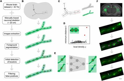 DeepBouton: Automated Identification of Single-Neuron Axonal Boutons at the Brain-Wide Scale